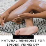 Natural Remedies For Spider Veins: DIY Treatments For Healthy Legs